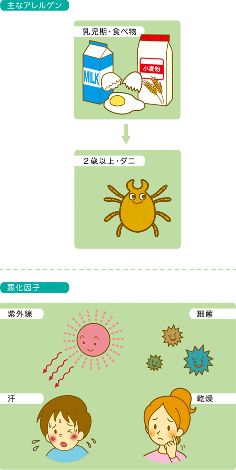 アトピー性皮膚炎の原因