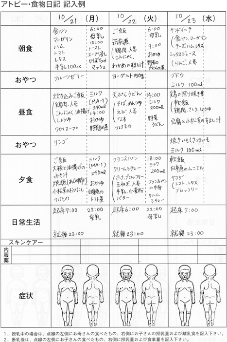 食物アレルギーの診断
